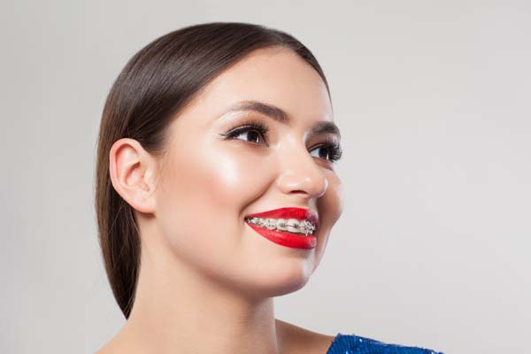 Why You Should Seek Out A Braces Specialist